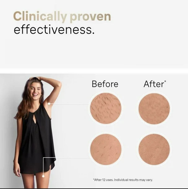 clinicallyproveneffectivenessbeforeandafterlaserhairremoval