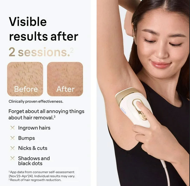 visibleresultsafter2sessionsbeforeandafterclinicallyproveneffectivenessforgetaboutallannoyingthingsabouthairremovalingrownhairsbrumpsnicksandcutsshadowsandblackdots
